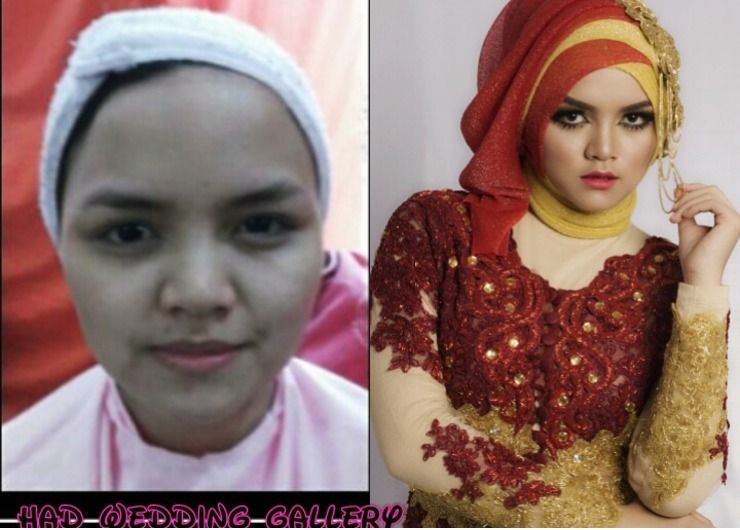 Before after inka
